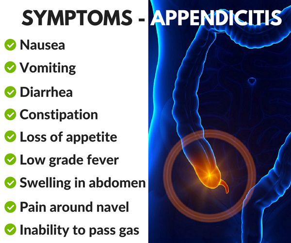 symptoms-appendicitis